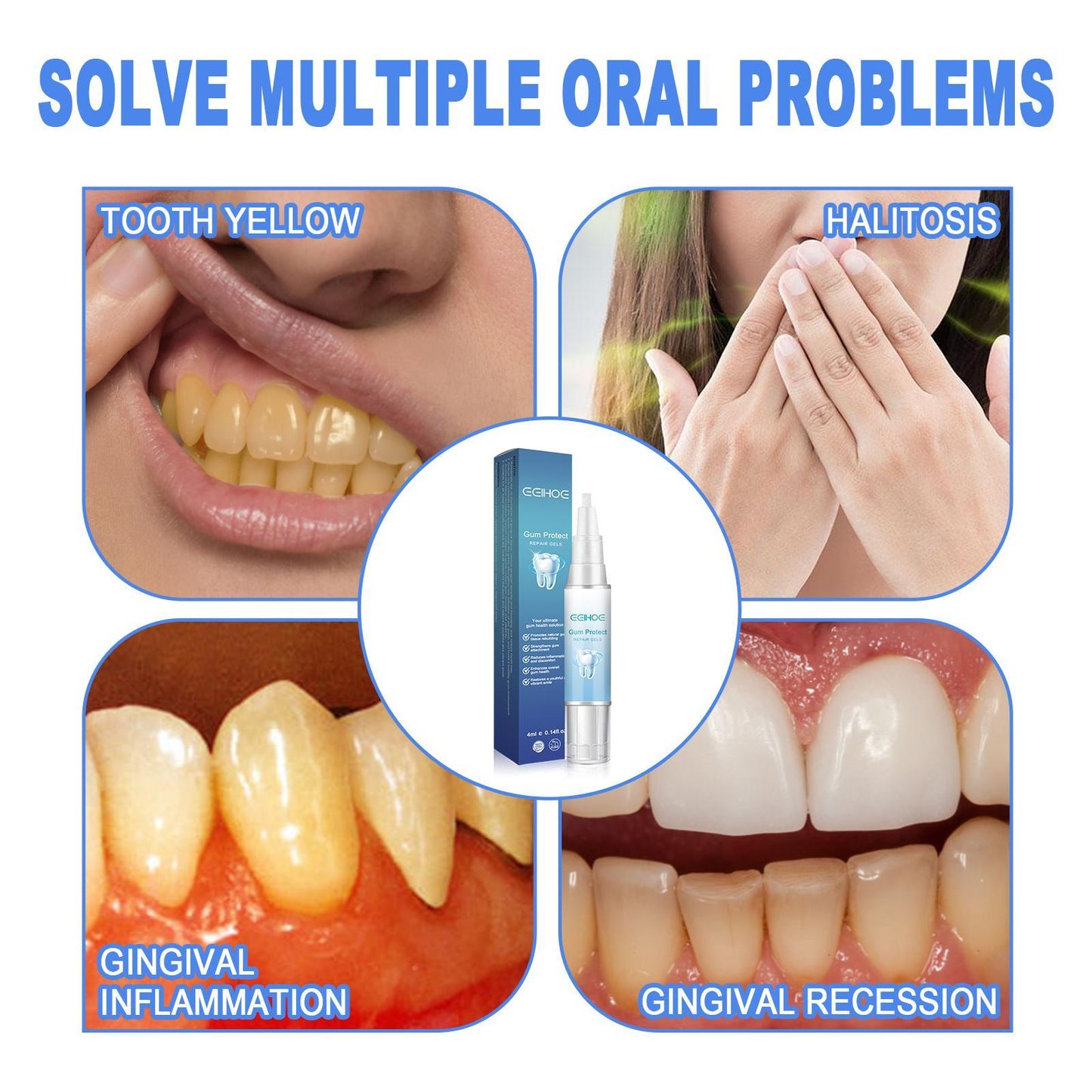 Yierhao Tooth Repair Gel, Repair Gums, Clean Teeth Stains, Tartar, Oral Care