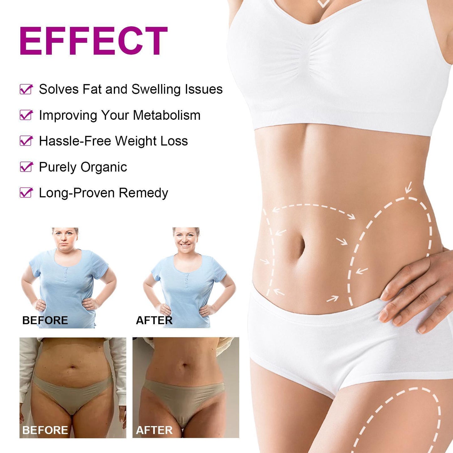 Yihe Abdomen Lifting Belt, Tightens Loose Skin And Reshapes Belly Button