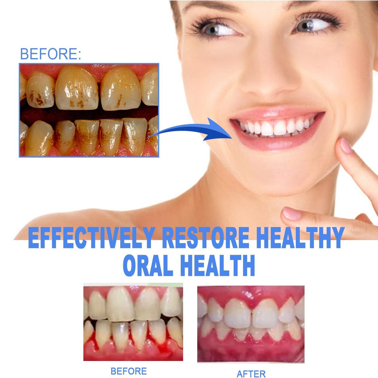 Yierhao Tooth Repair Gel, Repair Gums, Clean Teeth Stains, Tartar, Oral Care