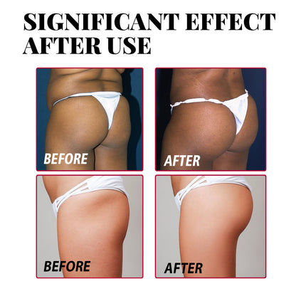Plump Buttock Cream Lifts And Tightens Buttocks - DropOnline.co