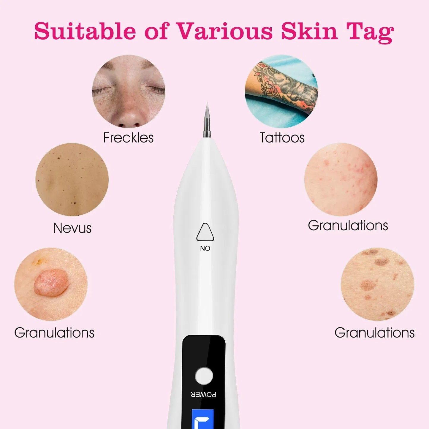 Skin Tag Repair Kit Portable Beauty Equipment Multi-Level With Home Usage USB Charging LCD Level Adjustable 6 Replaceable Needles