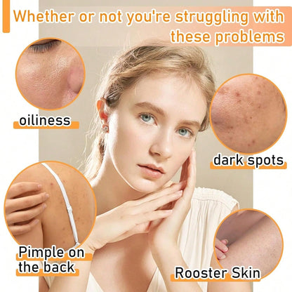 Turmeric Soap - DropOnline.co