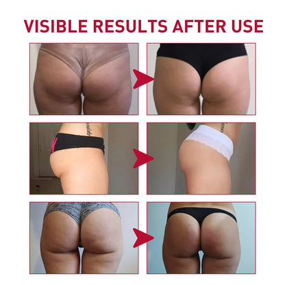 Plump Buttock Cream Lifts And Tightens Buttocks - DropOnline.co