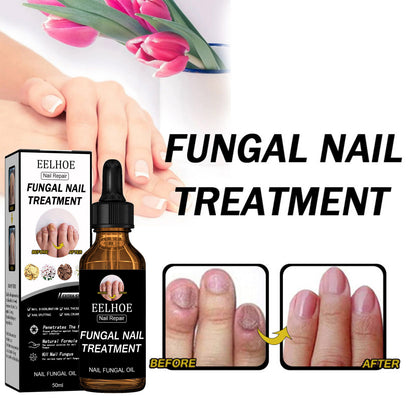 EELHOE Nail Repair Solution Thickening And Shining Nail Removal Dead Skin Repairing And Moisturizing Nail Nutritional Care Liquid - DropOnline.co