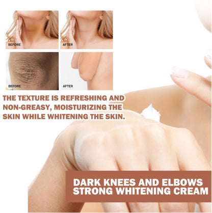 EELHOE Joint Darkening & Brightening Cream Moisturizing & Brightening Dark Skin Joint & Elbow Repair Cream - DropOnline.co