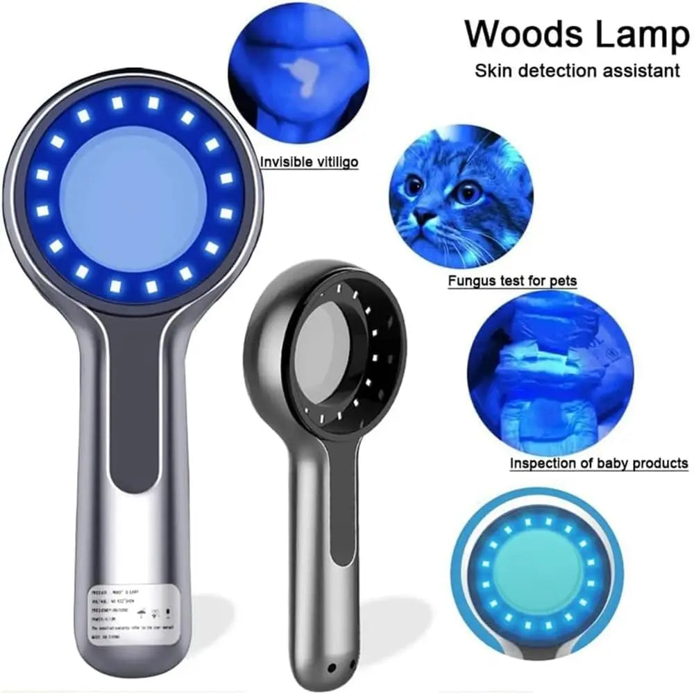 Woods Lamp Skin Analyzer – 365nm UV Light Magnifying Glass for Face Skin Analysis