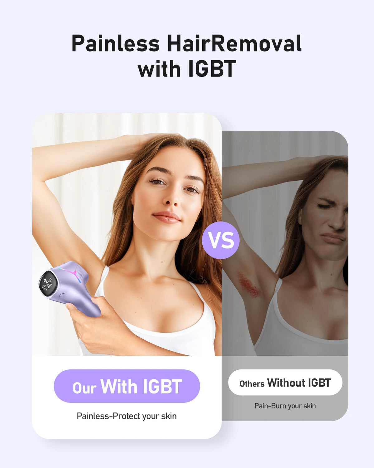 IPL Hair Reduction Device, 5.2cm² Window, 9 Levels