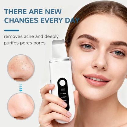 4-in-1 Ultrasonic Skin Scrubber, Ion Cleansing