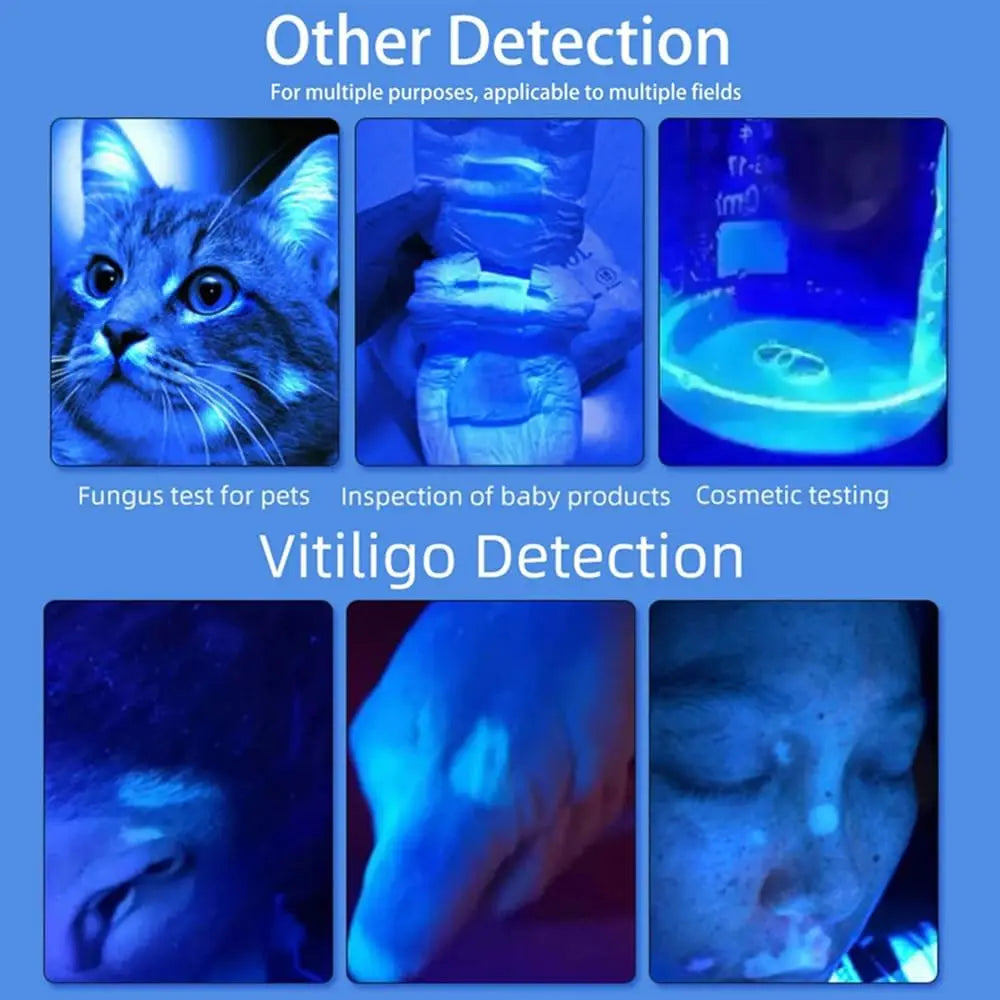 Woods Lamp Skin Analyzer – 365nm UV Light Magnifying Glass for Face Skin Analysis