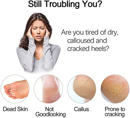 Electric Foot Grinder Vacuum Foot Grinding Machine Exfoliating Dead Skin Callus Remover Foot Care - DropOnline.co