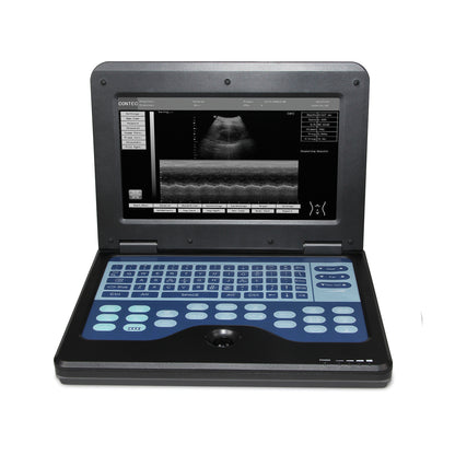 Digital Laptop Machine Ultrasound Scanner Convex 3.5Mhz Probe Abdominal For Human Use - DropOnline.co