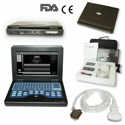 Digital Laptop Machine Ultrasound Scanner Convex 3.5Mhz Probe Abdominal For Human Use - DropOnline.co