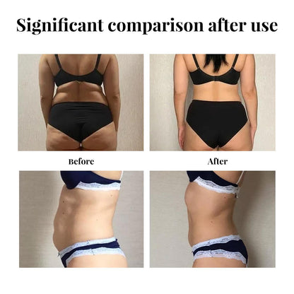 Yihe Abdomen Lifting Belt, Tightens Loose Skin And Reshapes Belly Button - DropOnline.co