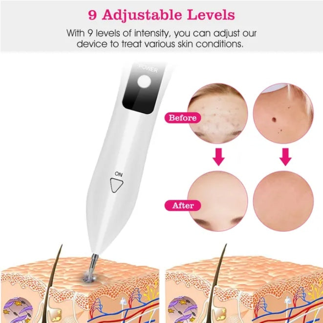Skin Tag Repair Kit Portable Beauty Equipment Multi-Level