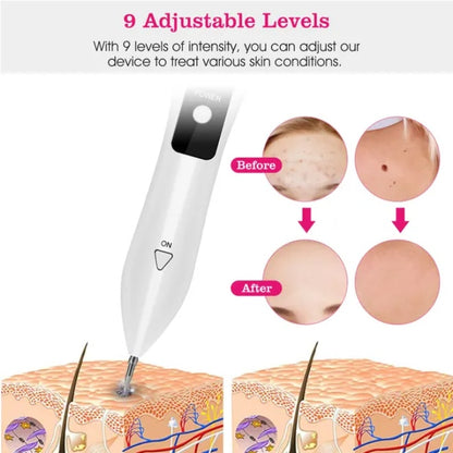 Skin Tag Repair Kit Portable Beauty Equipment Multi-Level - DropOnline.co