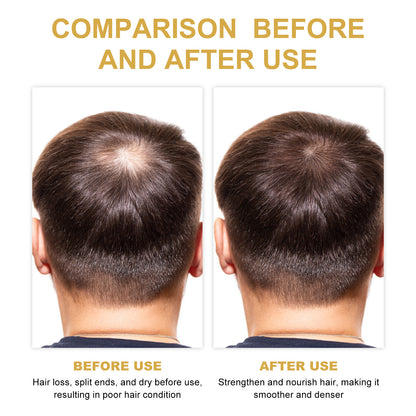 EELHOE Rosemary Hair Treatment Oil Scalp Cleansing Conditioning Volumizing Smoothing Repair Dry Frizzy Hair Conditioning Hair Treatment Oil - DropOnline.co