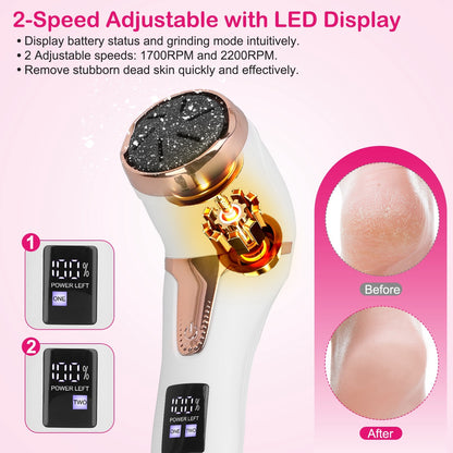 17Pcs Electric Foot Callus Remover With Vacuum Foot Grinder Rechargeable Foot File Dead Skin Pedicure Machine With 3 Grinding Heads 2 Speeds Foot Care Tool - DropOnline.co